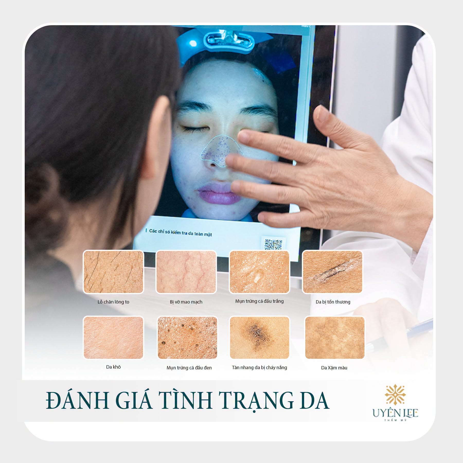 Theo Dõi Da Định Kỳ Tại Thẩm mỹ Uyên Lee