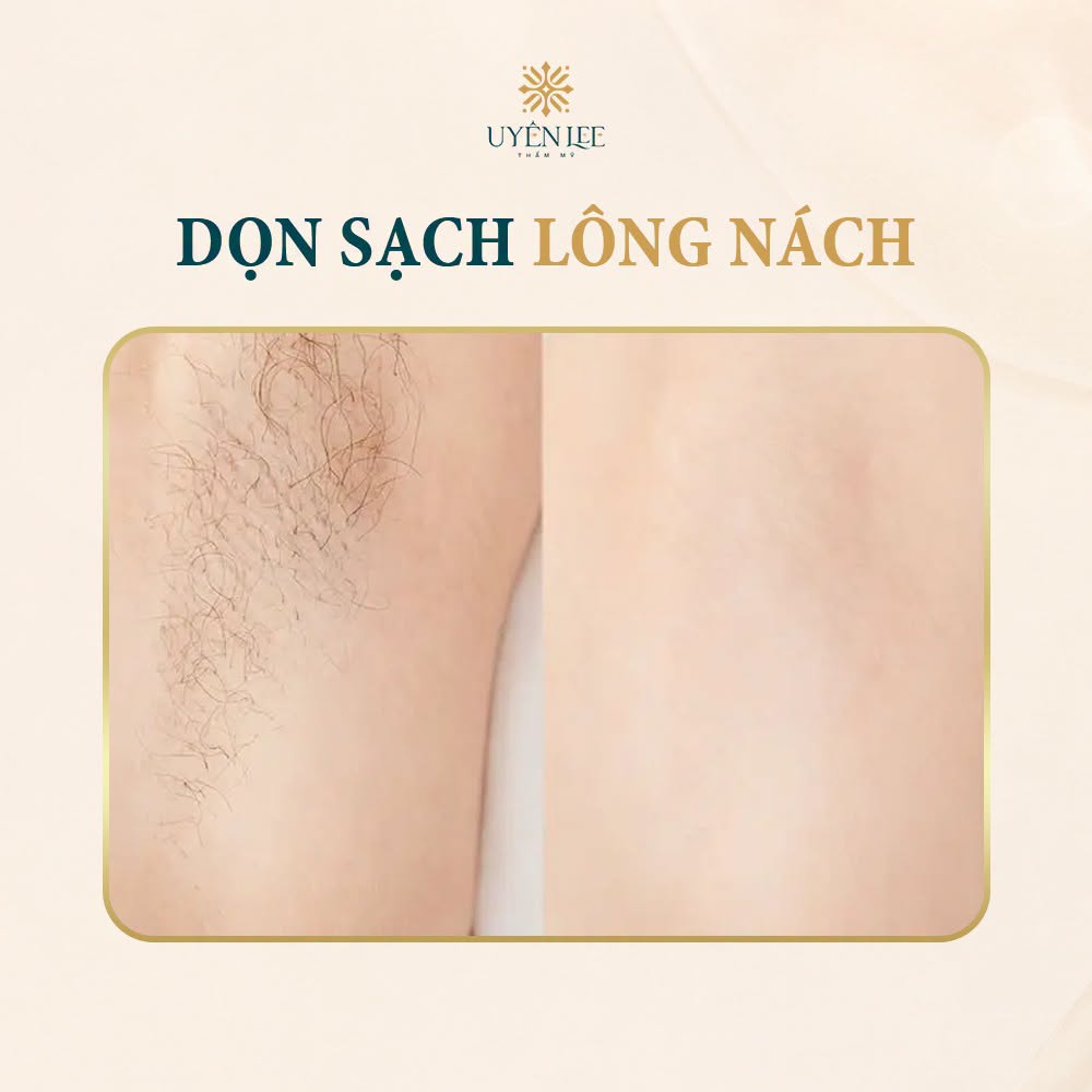 COMBO BA CHẠM RẠNG NGỜI- Dọn sạch lông nách tự tin mỗi ngày